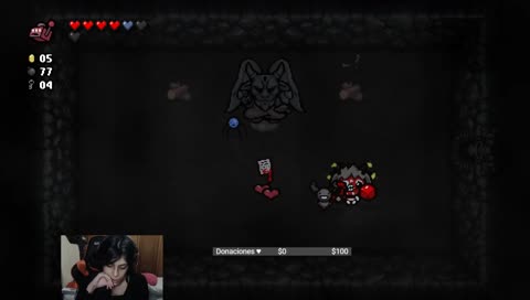 [MEX] Niño con hidrocefalia