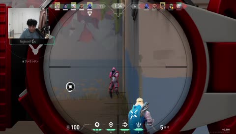 オペ橋ACE