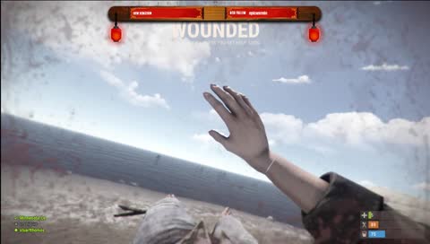 you like eating worms?