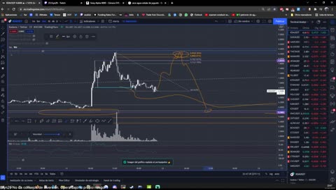 Irene Sonido Pikachu